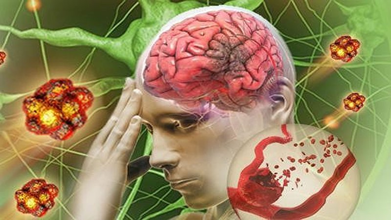 Cách phòng ngừa tai biến mạch máu não